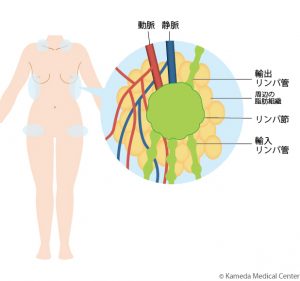 健常部位（鎖骨周囲、側胸部、鼡径部など）にあるリンパ節とその周囲の脂肪組織を、それを栄養する血管